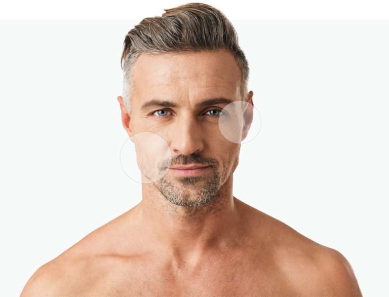 Dermal Fillers