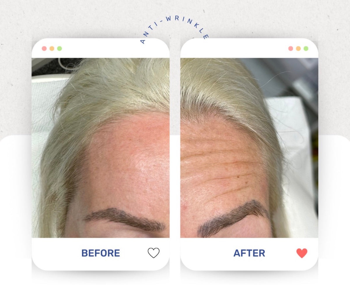 Before & After