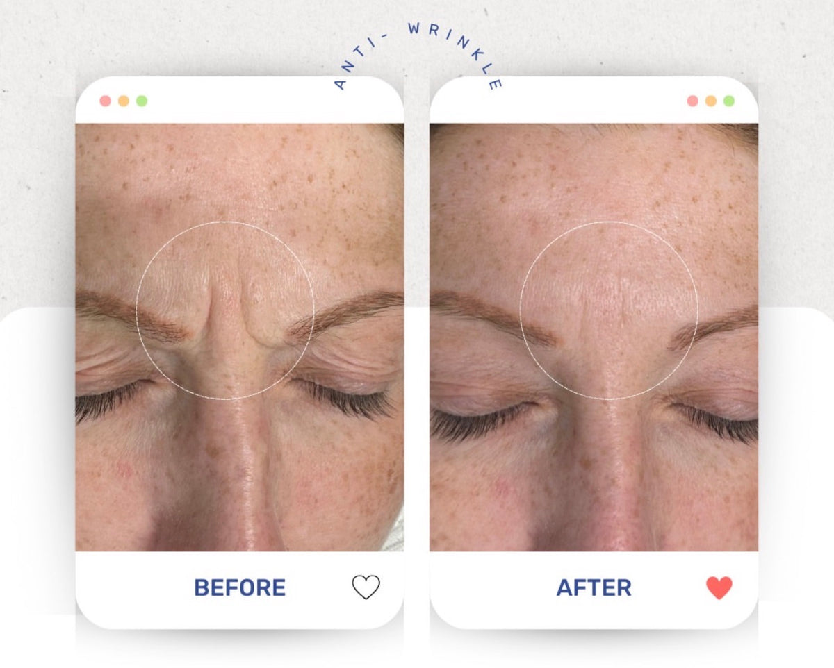 Before & After