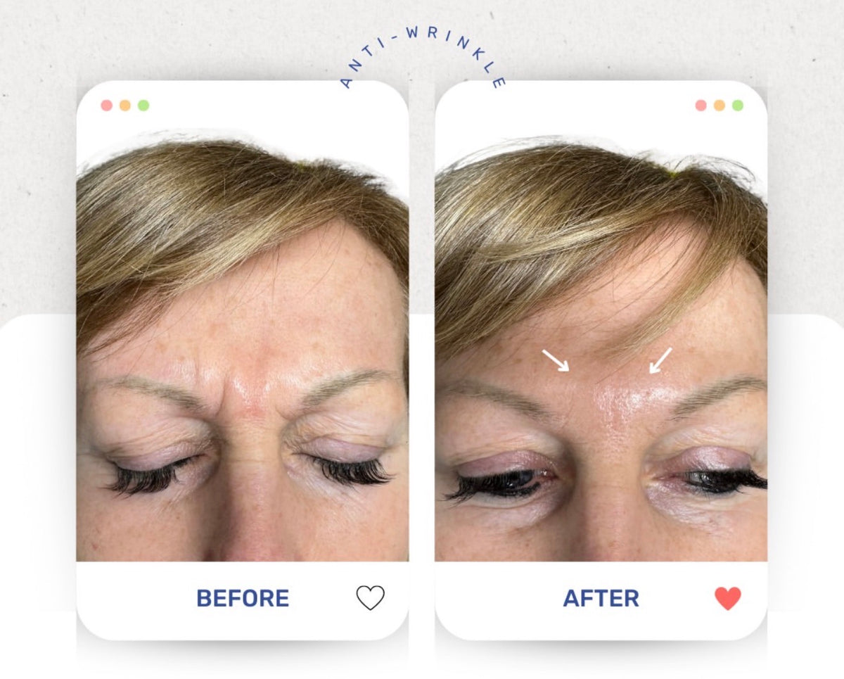 Before & After