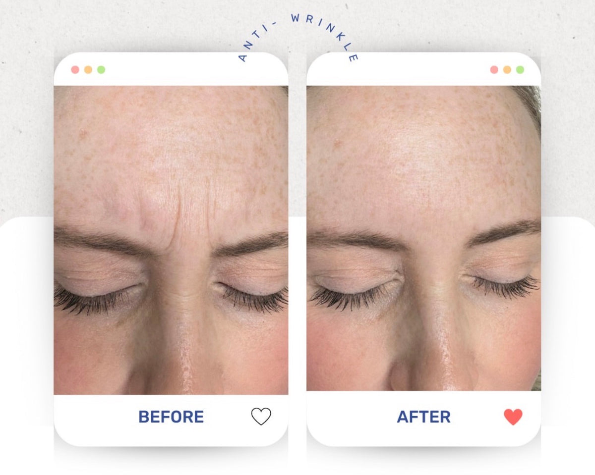 Before & After