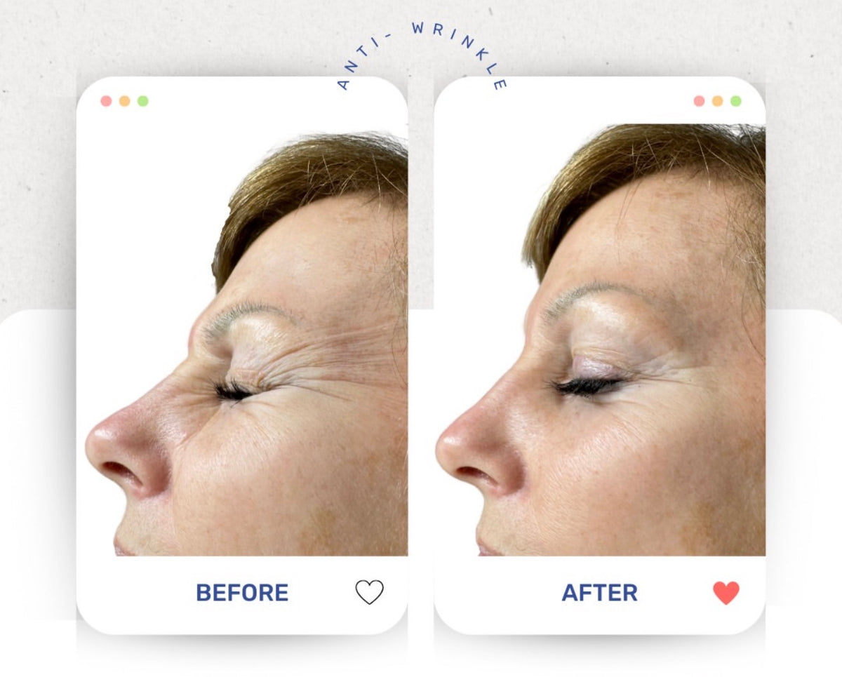 Before & After