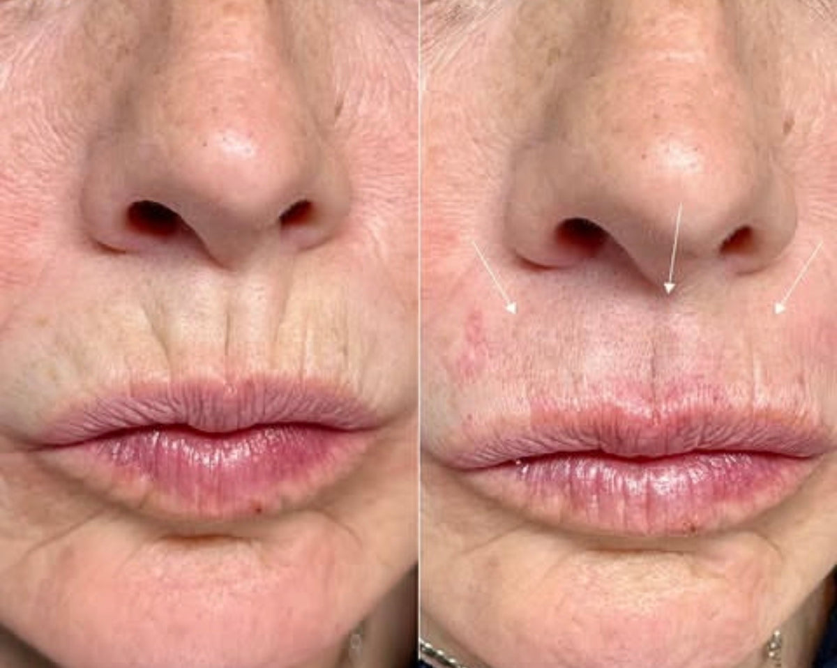 Before & After