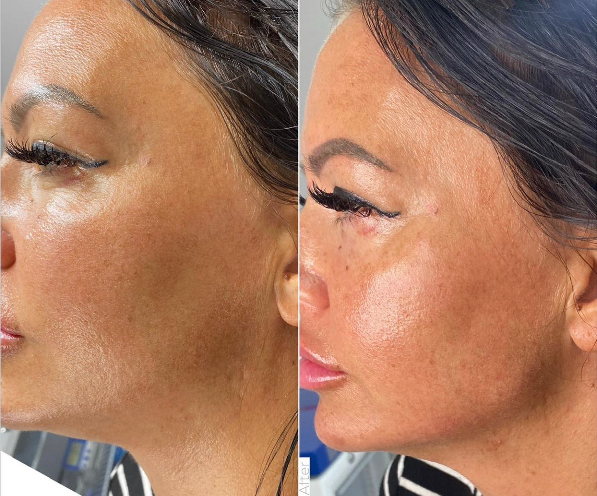 Before & After
