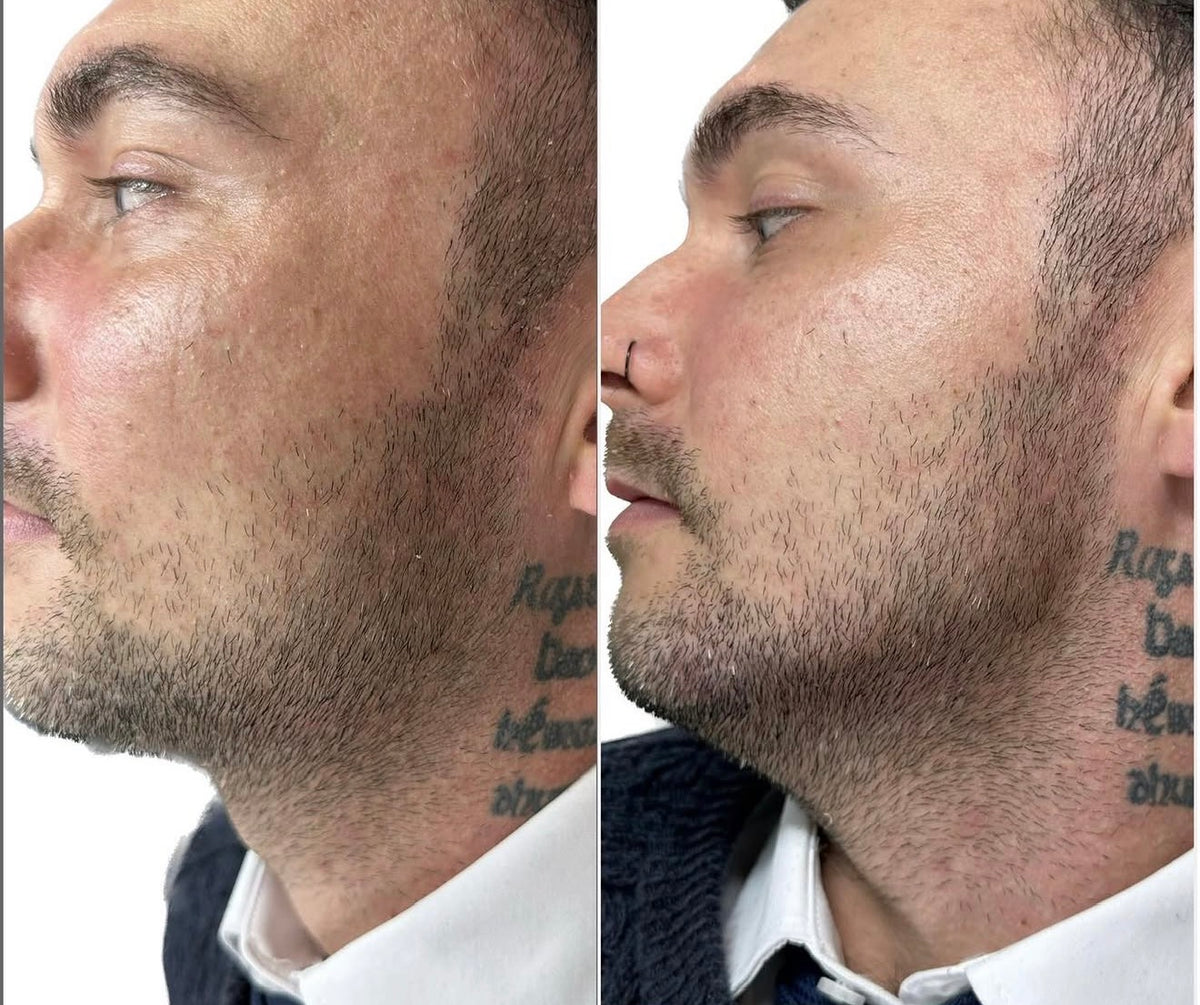 Before & After