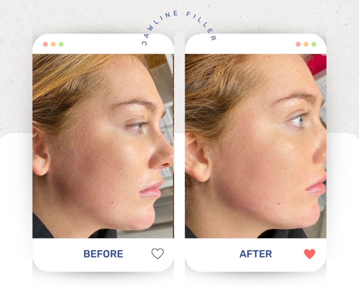 Before & After