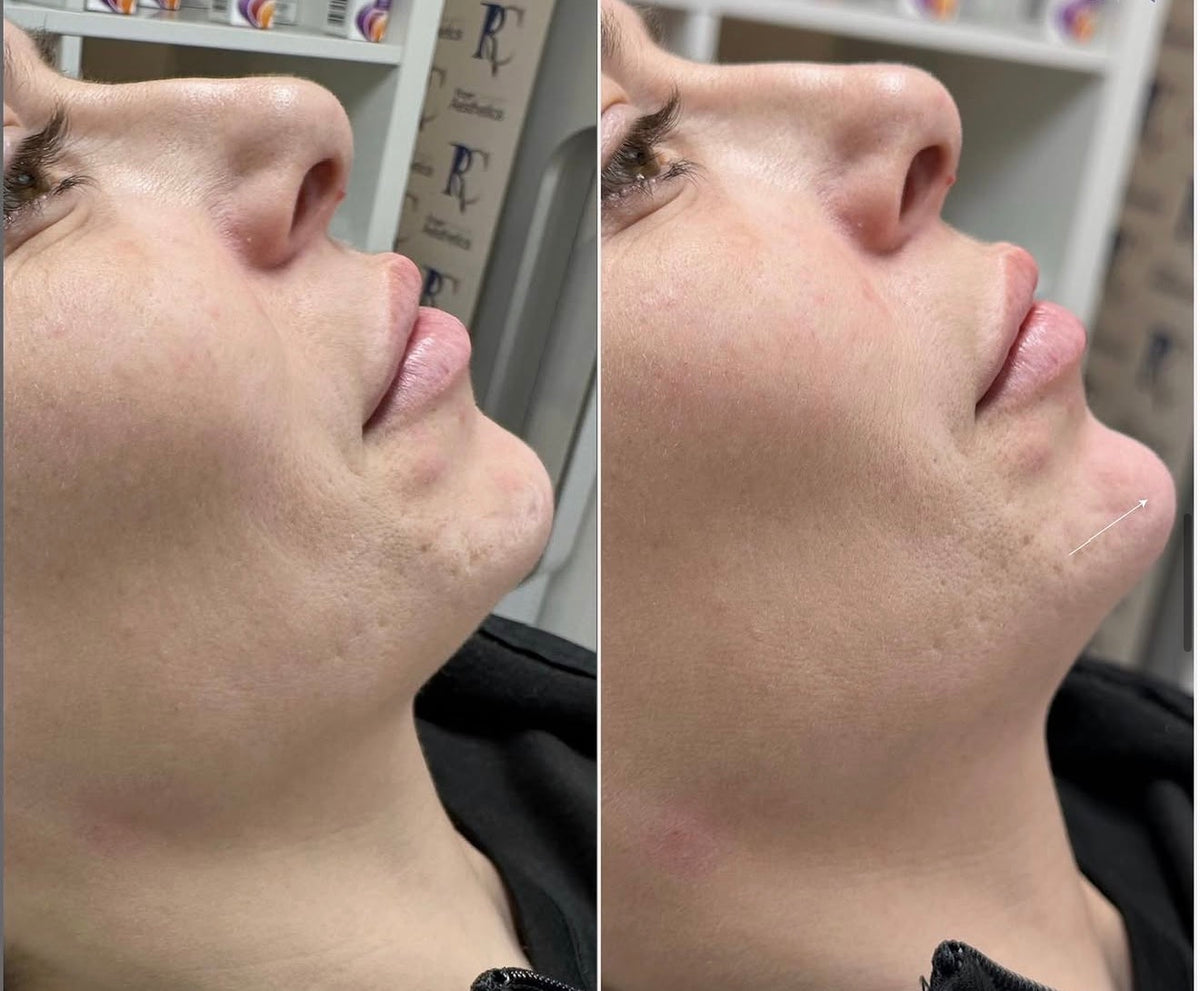 Before & After