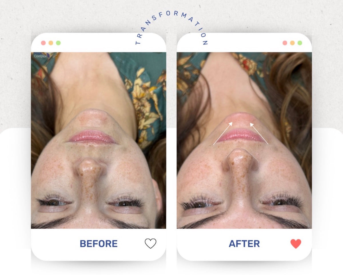 Before & After