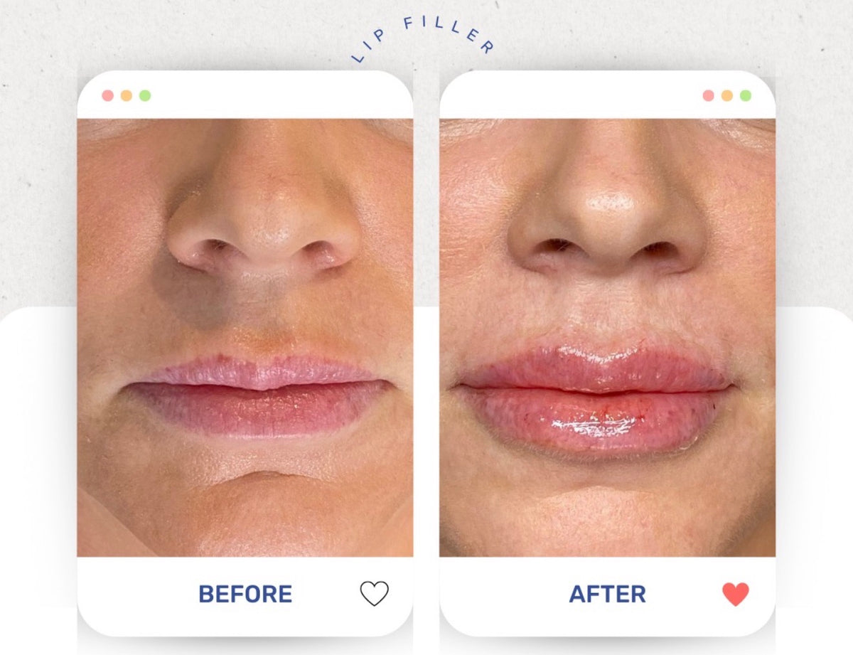 Before & After