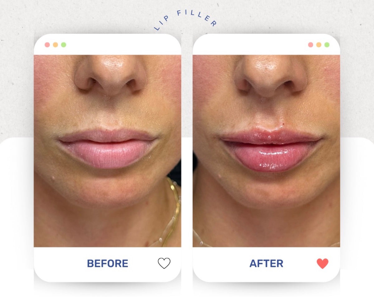 Before & After