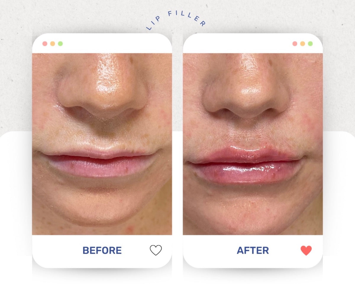 Before & After