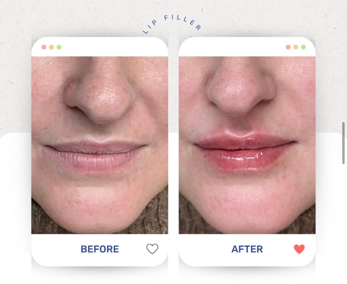 Before & After