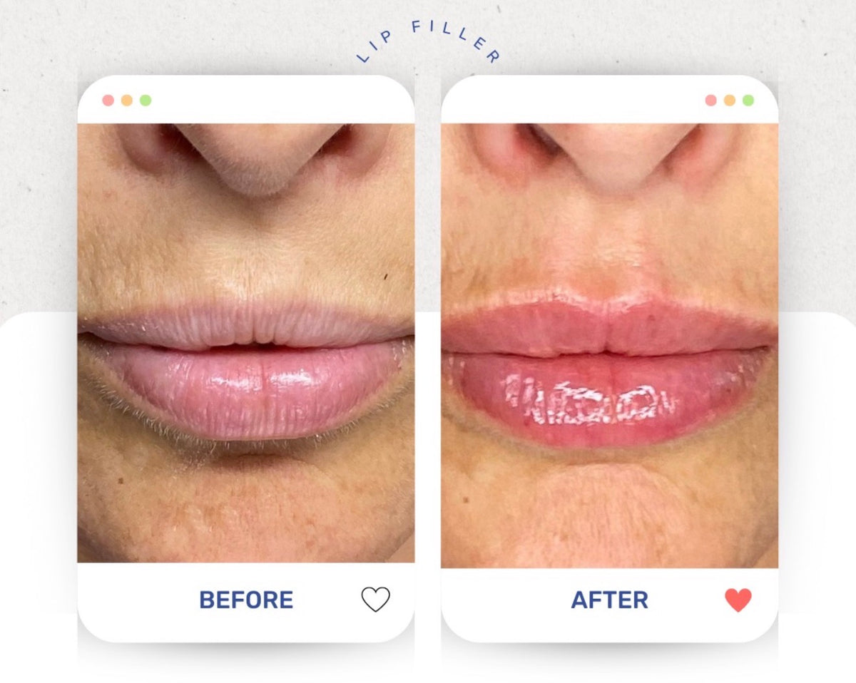 Before & After