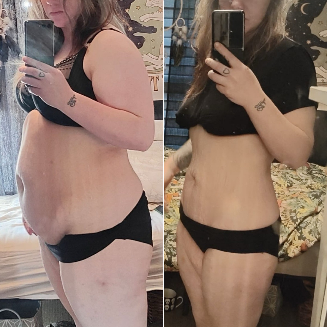 Before & After