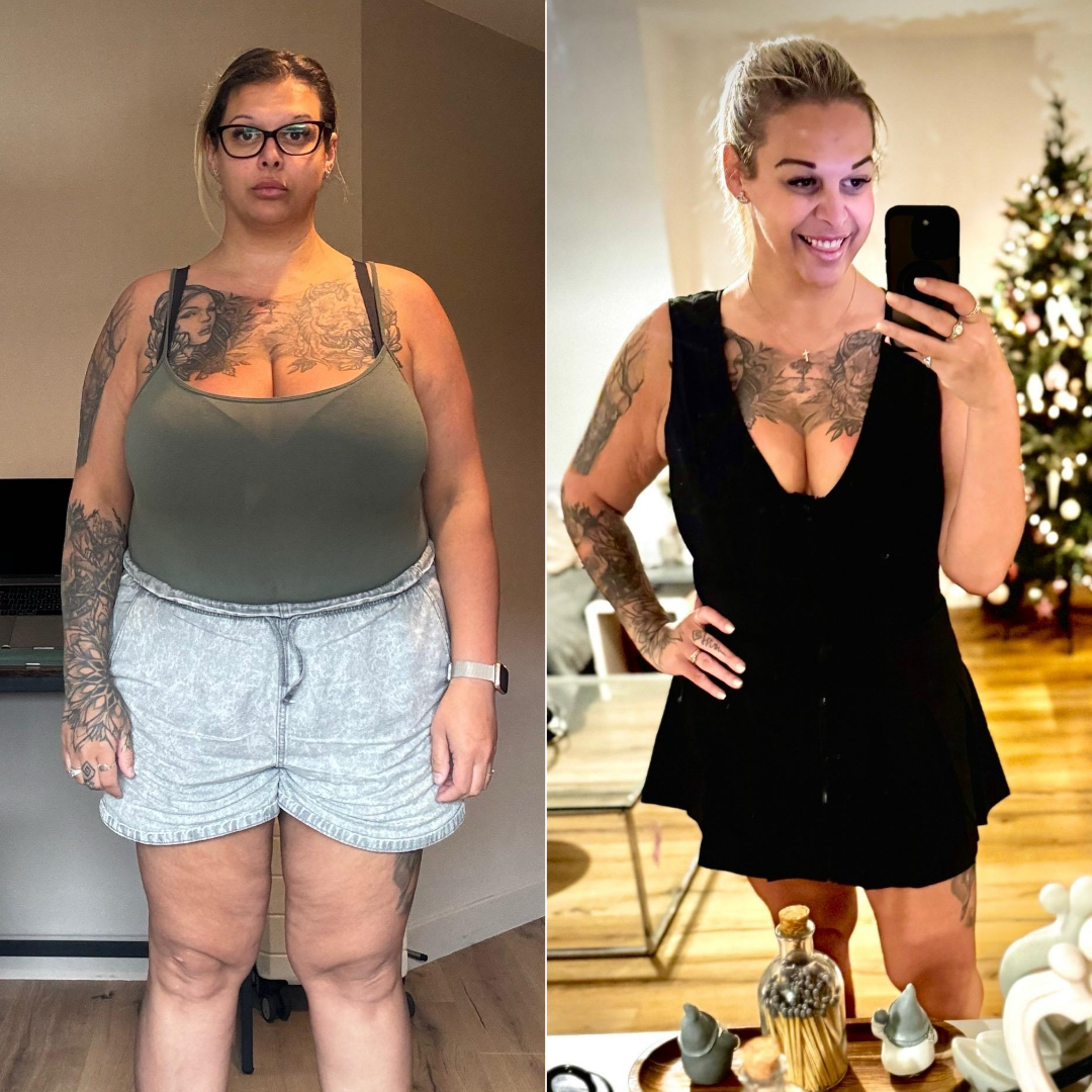 Before & After